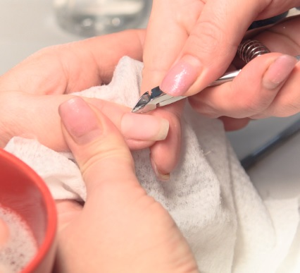 perché il gel si solleva