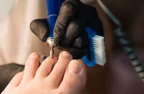 ricostruzione unghie dei piedi